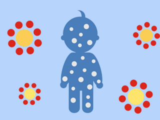 O papel da proteína na prevenção alérgica do bebé