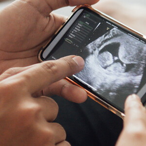 Ecografia das 12 semanas no telemóvel