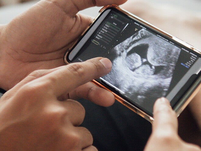 Ecografia das 12 semanas no telemóvel