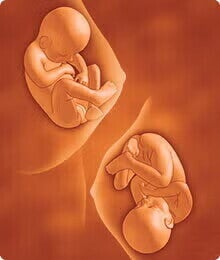 feto 33 semanas feto 33 semanas